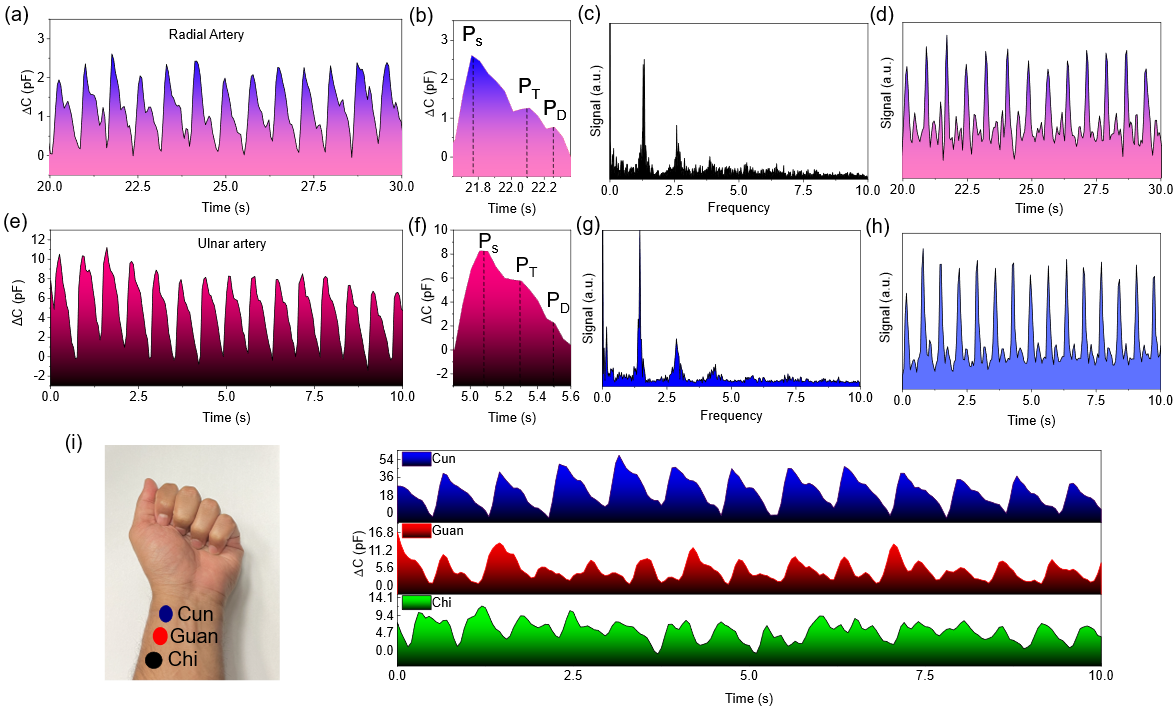 Radial Pulse Waveform